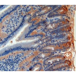 Angiopoietin-Related Protein 1 (ANGPTL1) Antibody