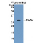 Western blot analysis of recombinant Human ANGPTL2.