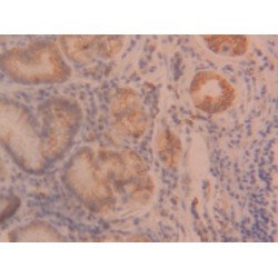 Angiopoietin-Related Protein 2 (ANGPTL2) Antibody