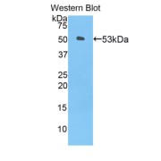 abx103092