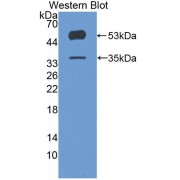 Western blot analysis of recombinant Human ANGPTL4.
