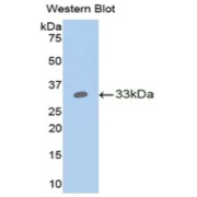 Western blot analysis of the recombinant protein.