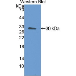 Angiopoietin-Related Protein 4 (ANGPTL4) Antibody