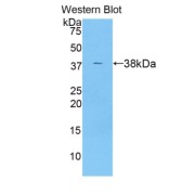 abx103101