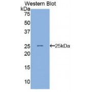 Western blot analysis of recombinant Human ANGPTL8.