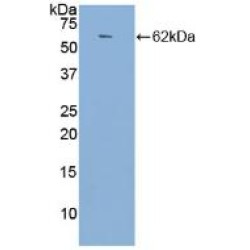 Angiotensin I Converting Enzyme (ACE) Antibody