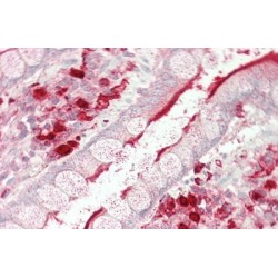 Angiotensin I Converting Enzyme (ACE) Antibody