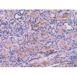 Angiotensin I Converting Enzyme (ACE) Antibody