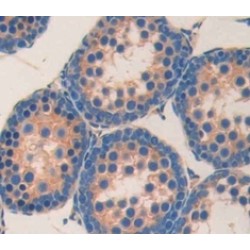 Angiotensin I Converting Enzyme (ACE) Antibody