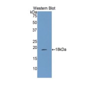 Western blot analysis of the recombinant protein.