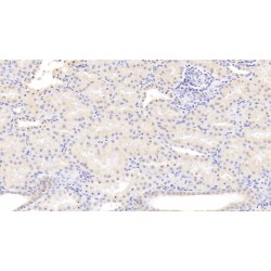 Polyunsaturated Fatty Acid Lipoxygenase ALOX15 (ALOX15) Antibody