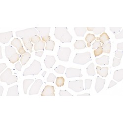 Polyunsaturated Fatty Acid Lipoxygenase ALOX15 (ALOX15) Antibody