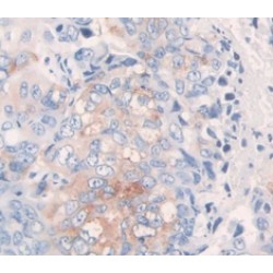 Bone Morphogenetic Protein 10 (BMP10) Antibody
