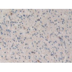 Bone Morphogenetic Protein 15 (BMP15) Antibody