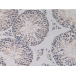 Bone Morphogenetic Protein 15 (BMP15) Antibody