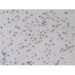 Bone Morphogenetic Protein 15 (BMP15) Antibody