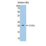 Western blot analysis of recombinant Human CBG.