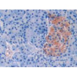 Corticosteroid Binding Globulin (SERPINA6) Antibody