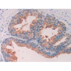 Corticosteroid Binding Globulin (SERPINA6) Antibody