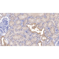 Corticotropin Releasing Hormone (CRH) Antibody