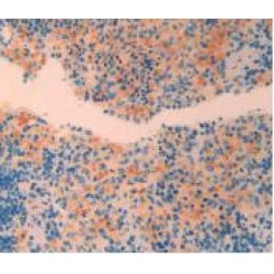 Corticotropin Releasing Hormone (CRH) Antibody