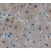 IHC-P analysis of Human Tissue, with DAB staining.