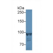 Western blot analysis of Mouse Skeletal muscle lysate, using Mouse PYGM Antibody (2 µg/ml) and HRP-conjugated Goat Anti-Rabbit antibody (<a href="https://www.abbexa.com/index.php?route=product/search&amp;search=abx400043" target="_blank">abx400043</a>, 0.2 µg/ml).