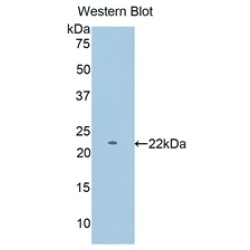 Glycogen Phosphorylase, Muscle (PYGM) Antibody