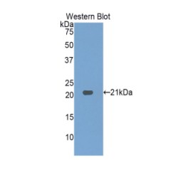 Hepatoma Derived Growth Factor (HDGF) Antibody