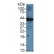 Western blot analysis of Human Raji cell lysate, using Human Iga Antibody (1 µg/ml) and HRP-conjugated Goat Anti-Rabbit antibody (<a href="https://www.abbexa.com/index.php?route=product/search&amp;search=abx400043" target="_blank">abx400043</a>, 0.2 µg/ml).