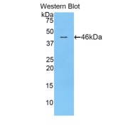 abx103156