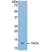 Western blot analysis of recombinant Mouse ICOS.