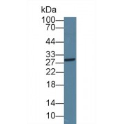 Western blot analysis of Rat Liver lysate, using Rat ICOS Antibody (1 µg/ml) and HRP-conjugated Goat Anti-Rabbit antibody (<a href="https://www.abbexa.com/index.php?route=product/search&amp;search=abx400043" target="_blank">abx400043</a>, 0.2 µg/ml).