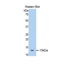 Inducible T-Cell Costimulator (ICOS) Antibody