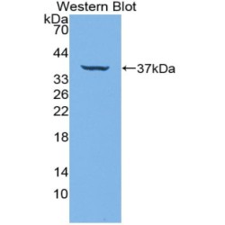 Interferon Regulatory Factor 6 (IRF6) Antibody