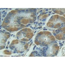 Interleukin 1 Receptor Type I (IL1R1) Antibody