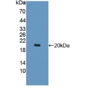 Western blot analysis of recombinant Human IL10Rb.