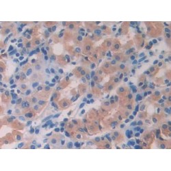 Interleukin 10 Receptor Beta (IL10Rb) Antibody