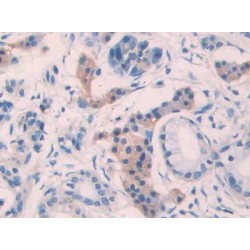 Interleukin 10 Receptor Beta (IL10Rb) Antibody