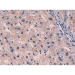 Interleukin 10 Receptor Beta (IL10Rb) Antibody