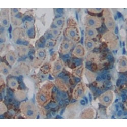 Interleukin 10 Receptor Beta (IL10Rb) Antibody