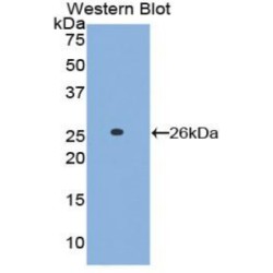 Linker For Activation of T-Cell (LAT) Antibody