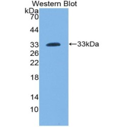 Lymphocyte Cytosolic Protein 2 (LCP2) Antibody