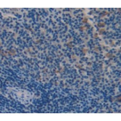 Macrophage Expressed Protein 1 (MPG1) Antibody