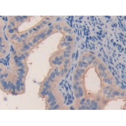 Monocyte Chemotactic Protein 3 (MCP3) Antibody