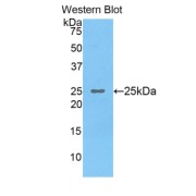 Western blot analysis of the recombinant protein.