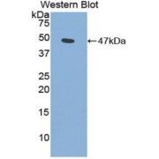 Western blot analysis of the recombinant protein.
