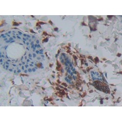 Phospholipase A2, Group IIA (PLA2G2A) Antibody