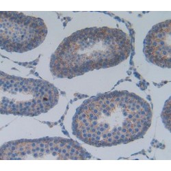 Phospholipase A2, Group IIA (PLA2G2A) Antibody