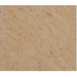 Phospholipase A2, Group IID (PLA2G2D) Antibody